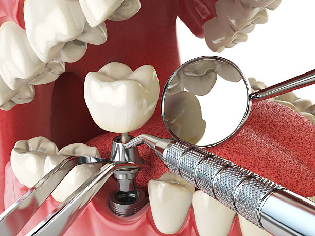 Best Emergency Dental Care for Sports Injuries in Orange City, IA