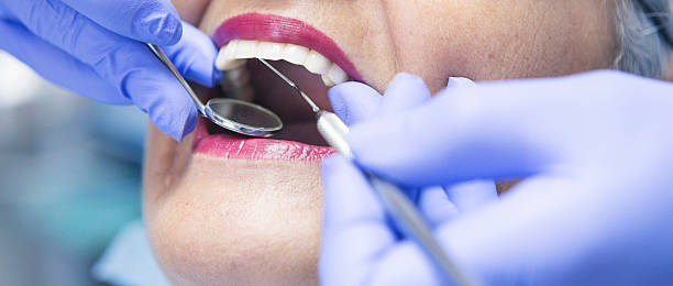 Best Emergency Treatment for Oral Infections in Orange City, IA