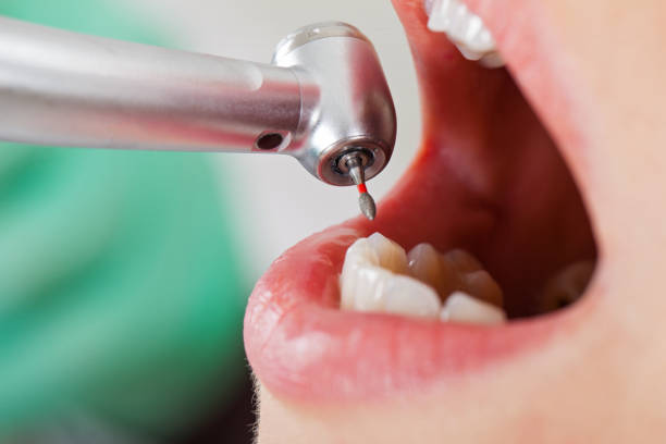 Best Emergency Treatment for Oral Infections in Orange City, IA